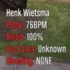 ESX Medical System – Real-time health stats display for players in FiveM roleplay servers