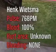 ESX Medical System – Real-time health stats display for players in FiveM roleplay servers